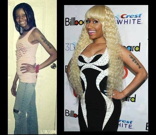 Pictures Of Nicki Minaj Before Plastic Surgery That You Must See